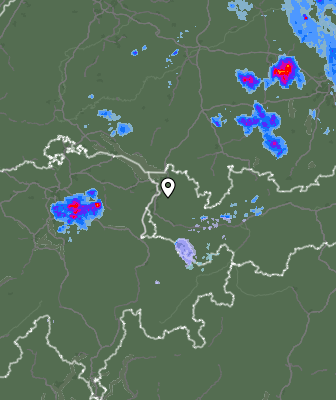 Radar