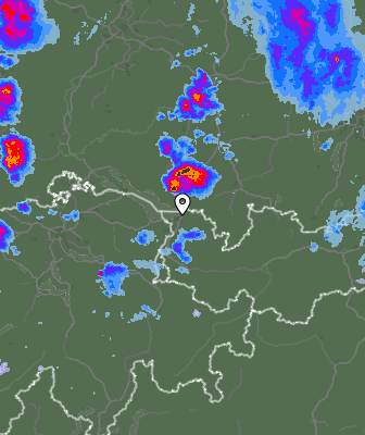 Radar