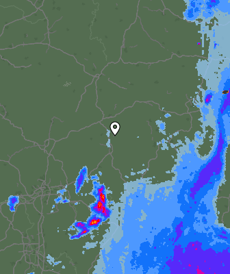Radar