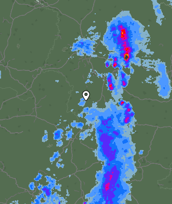 Radar