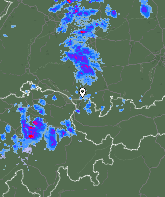 Radar