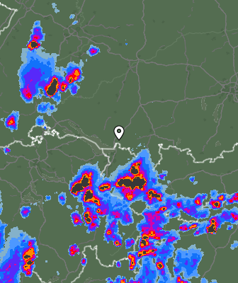 Radar