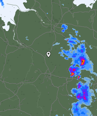 Radar