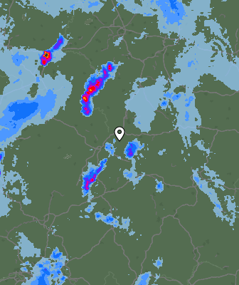 Radar