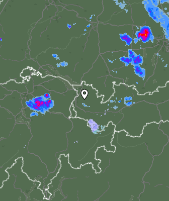Radar