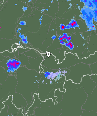 Radar