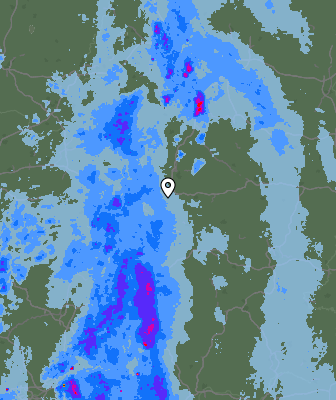 Radar