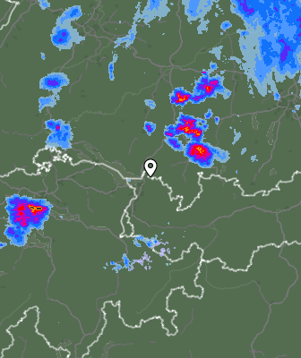 Radar