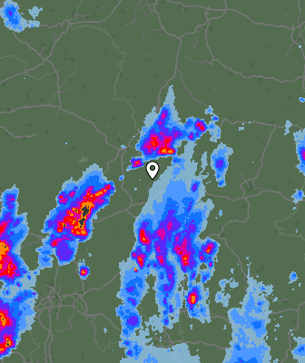 Radar