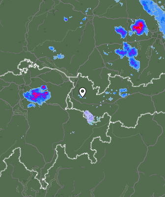 Radar