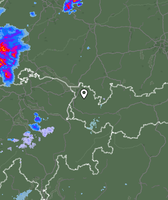 Radar