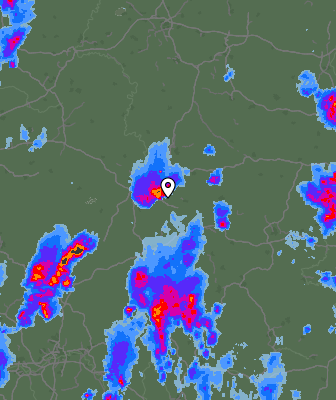 Radar