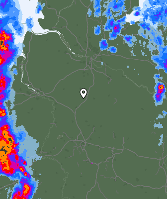Radar
