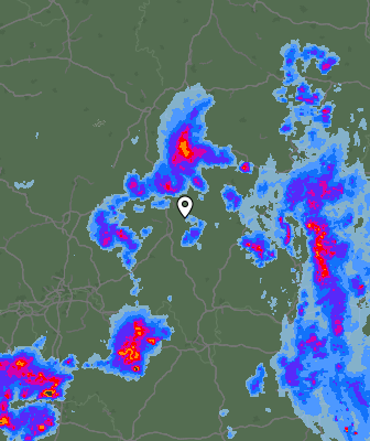 Radar