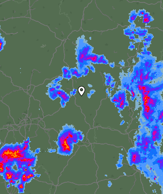 Radar