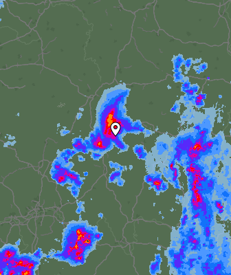 Radar