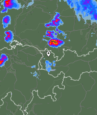 Radar