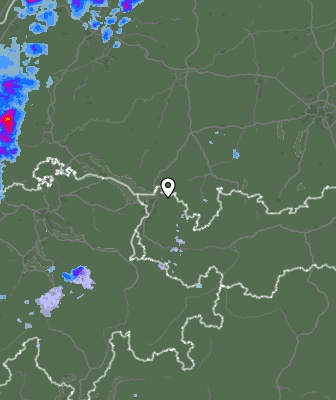 Radar