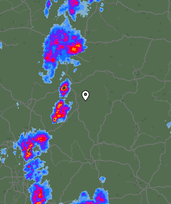 Radar