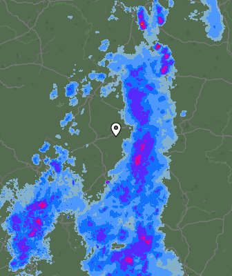 Radar