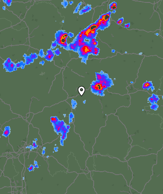 Radar