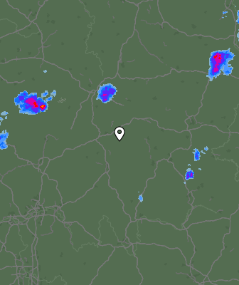 Radar