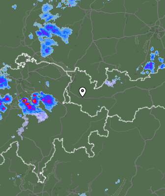 Radar