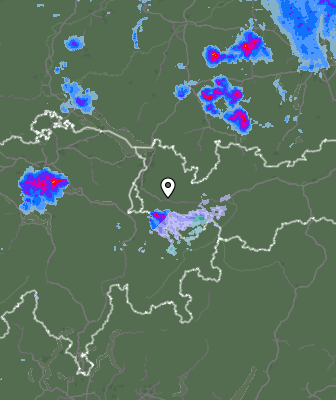 Radar