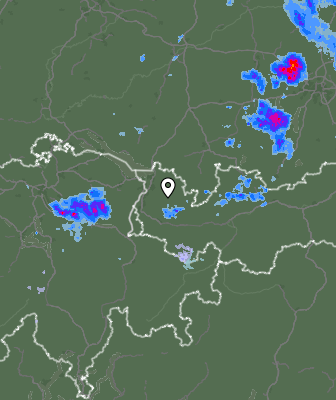 Radar