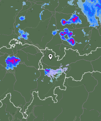 Radar