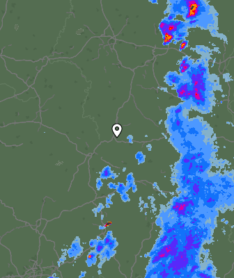 Radar