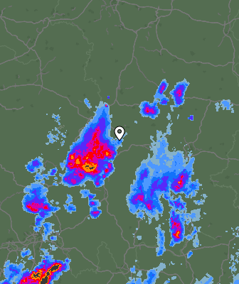 Radar