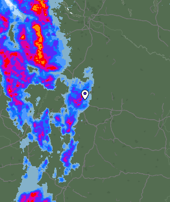 Radar