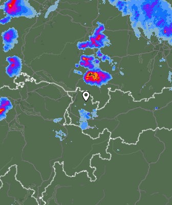 Radar