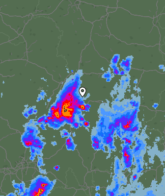 Radar