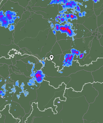 Radar