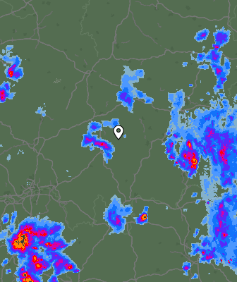 Radar