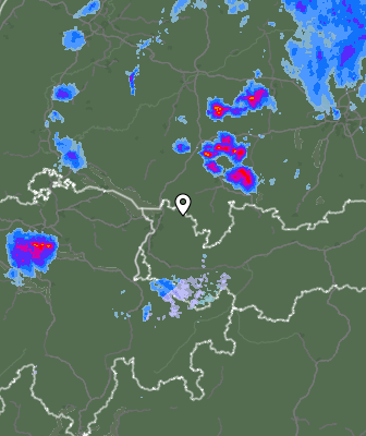 Radar