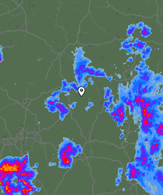 Radar