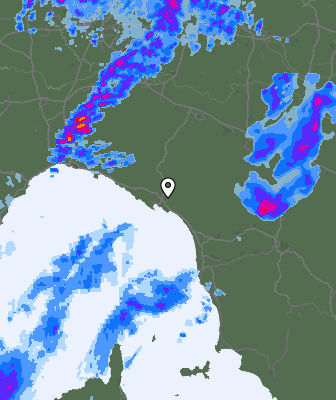Radar