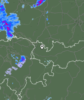 Radar