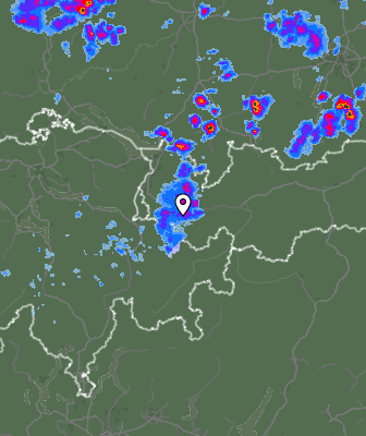 Radar
