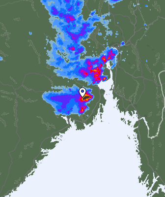 Radar