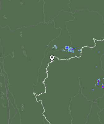 Radar