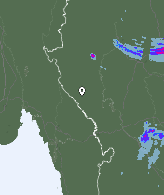 Radar