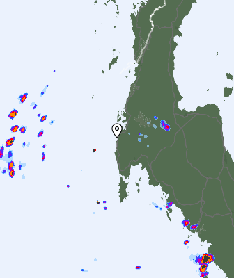 Radar