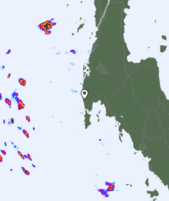Radar