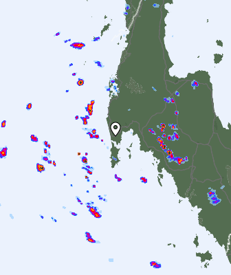 Radar