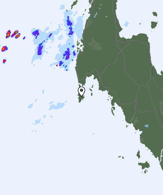 Radar