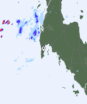 Radar